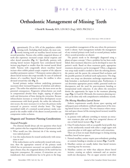 Orthodontic Management of Missing Teeth