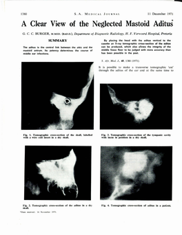 A 'Clear View of the N,Eglected Mastoid Aditus