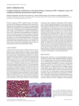 Complete Remission of Refractory, Ulcerated, Primary Cutaneous CD30+ Anaplastic Large Cell Lymphoma Following Brentuximab Vedotin Therapy