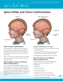 Spina Bifida and Chiari Malformation