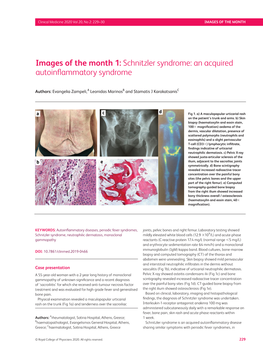 Images of the Month 1: Schnitzler Syndrome