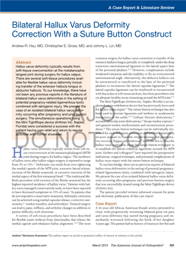 Bilateral Hallux Varus Deformity Correction with a Suture Button Construct