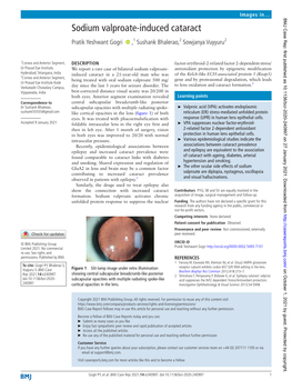 Sodium Valproate-Induced Cataract­ Pratik Yeshwant Gogri ‍ ‍ ,1 Sushank Bhalerao,2 Sowjanya Vuyyuru2