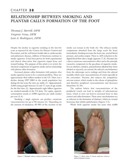 “Relationship Between Smoking and Plantar Callus