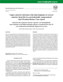 Upper Anterior Intrusion with Mini-Implants to Correct Anterior Deep Bite in a Periodontally Compromised Class II Malocclusion