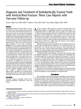 Diagnosis and Treatment of Endodontically Treated Teeth With