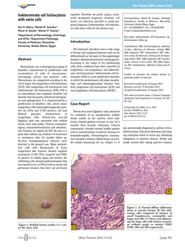 Indeterminate Cell Histiocytosis with Naïve Cells