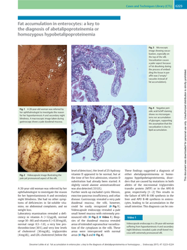 Fat Accumulation in Enterocytes: a Key to the Diagnosis of Abetalipoproteinemia Or Homozygous Hypobetalipoproteinemia