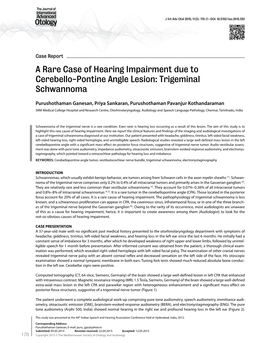 A Rare Case of Hearing Impairment Due to Cerebello-Pontine Angle Lesion: Trigeminal Schwannoma