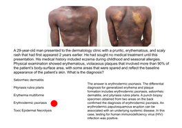 A 29-Year-Old Man Presented to the Dermatology Clinic with a Pruritic, Erythematous, and Scaly Rash That Had First Appeared 2 Years Earlier