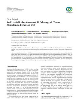 An Extrafollicular Adenomatoid Odontogenic Tumor Mimicking a Periapical Cyst