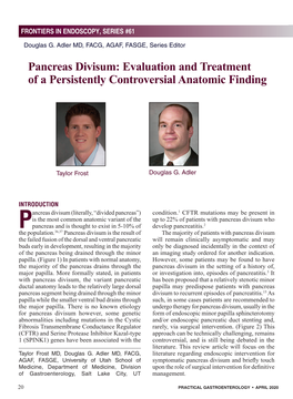 Pancreas Divisum: Evaluation and Treatment of a Persistently Controversial Anatomic Finding