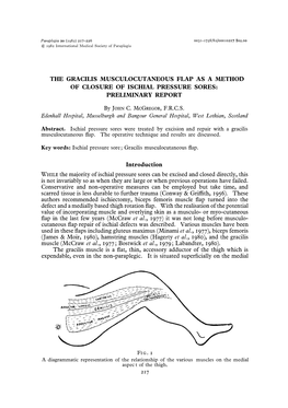 The Gracilis Musculocutaneous Flap As a Method of Closure of Ischial Pressure Sores: Preliminary Report