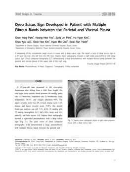 Deep Sulcus Sign Developed in Patient with Multiple Fibrous Bands Between the Parietal and Visceral Pleura