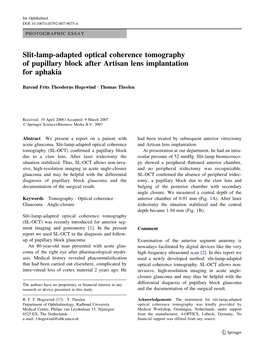 Slit-Lamp-Adapted Optical Coherence Tomography of Pupillary Block After Artisan Lens Implantation for Aphakia