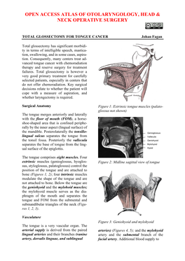 TOTAL GLOSSECTOMY for TONGUE CANCER Johan Fagan