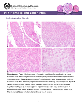 Skeletal Muscle – Fibrosis