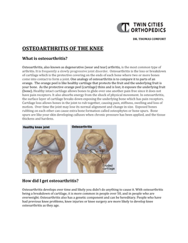 Osteoarthritis of the Knee