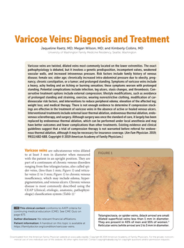 Varicose Veins