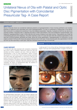 Unilateral Nevus of Ota with Palatal and Optic Disc