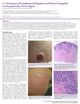 Co-Occurrence of Lymphomatoid Papulosis and Mycosis Fungoides in a Young Female: a Case Report Natalie Steinhoff, DO,* Brian Wanner,** Matthew H