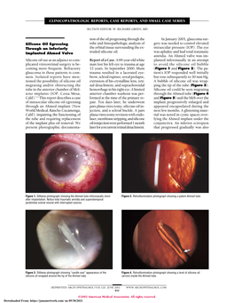 Retinitis Pigmentosa Associated with Ectopia Lentis