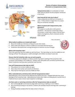 Petubes Patient Handout.Pdf