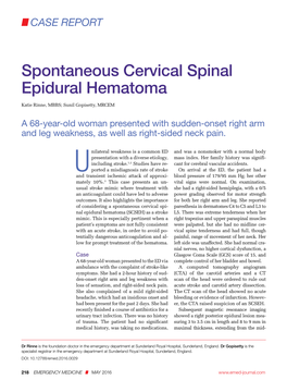 Spontaneous Cervical Spinal Epidural Hematoma