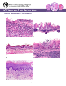 Stomach, Forestomach – Inflammation