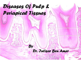 DISORDERS of the PULP & PERIPAICAL TISSUES Prepared By