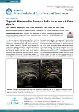 Musculoskeletal Disorders and Treatment