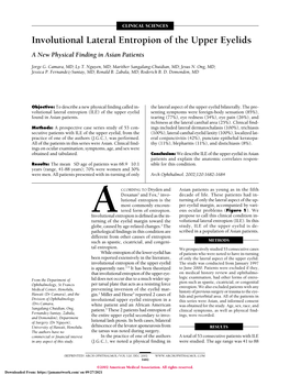 Involutional Lateral Entropion of the Upper Eyelids a New Physical Finding in Asian Patients