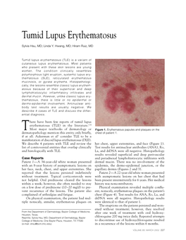 Tumid Lupus Erythematosus