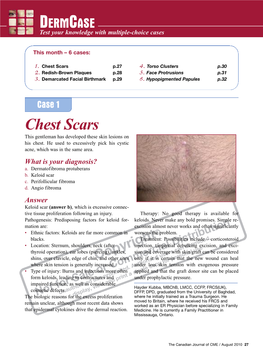 Chest Scars P.27 4