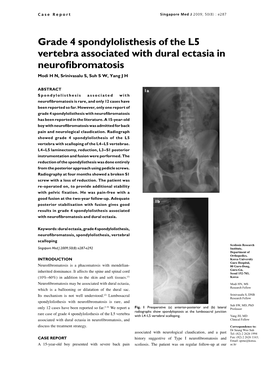 Grade 4 Spondylolisthesis of the L5 Vertebra Associated with Dural Ectasia in Neurofibromatosis Modi H N, Srinivasalu S, Suh S W, Yang J H
