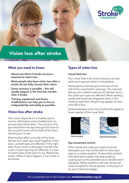 Vision Loss After Stroke Fact Sheet