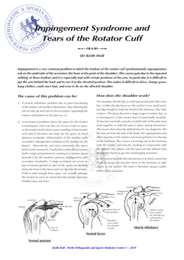 Impingement Syndrome and Tears of the Rotator Cuff