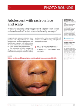 Adolescent with Rash on Face and Scalp