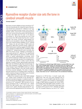 Ryanodine Receptor Cluster Size Sets the Tone in Cerebral Smooth Muscle