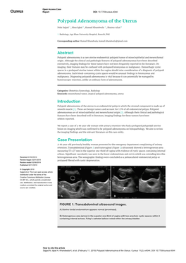 Polypoid Adenomyoma of the Uterus