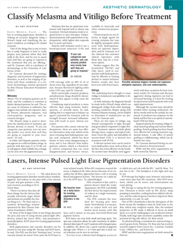 Lasers, Intense Pulsed Light Ease Pigmentation Disorders