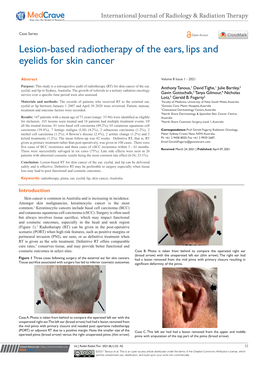 Lesion-Based Radiotherapy of the Ears, Lips and Eyelids for Skin Cancer