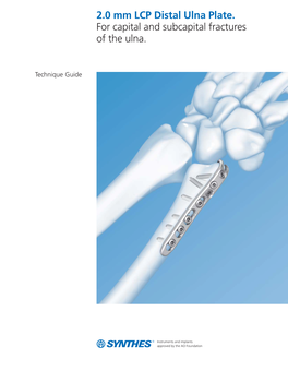 2.0 Mm LCP Distal Ulna Plate TG