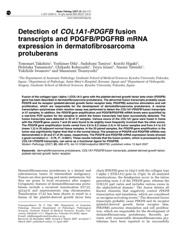 Detection of COL1A1-PDGFB Fusion Transcripts and PDGFB/PDGFRB Mrna Expression in Dermatofibrosarcoma Protuberans