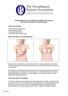 Dumping Syndrome and Digestion Problems After Surgery by James Gossage, Consultant Surgeon Common Problems: 'I Have Difficulty