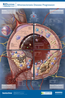 PM Coronary Artery Atherosclerosis 8740 Online