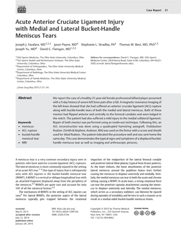 Acute Anterior Cruciate Ligament Injury with Medial and Lateral Bucket-Handle Meniscus Tears