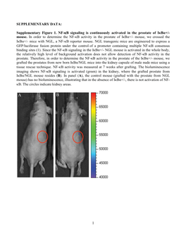 Activation of NF-Κb Signaling Promotes Prostate Cancer Progression in the Mouse and Predicts Poor Progression and Death in Pati