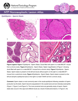 Epididymis – Sperm Stasis