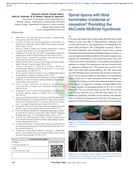 Spinal Lipoma with Tibial Hemimelia—Incidental Or Causative?